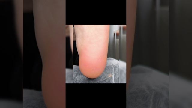 VID_22480320_090217_369.mp4