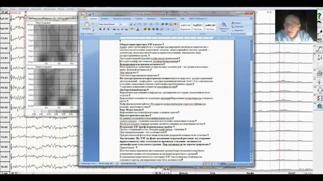 Как читать электроэнцефалограмму?