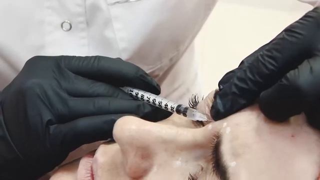 Ксеомин: индивидуальный подход. Две модели.