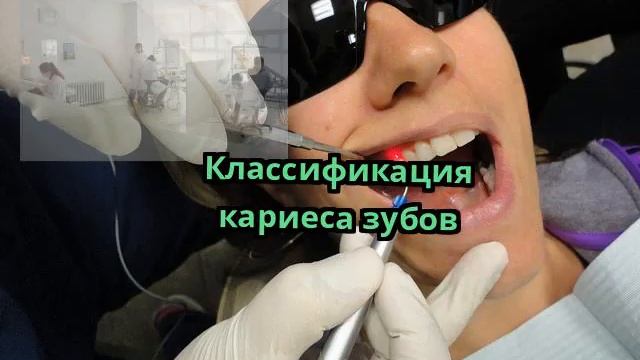 Классификация кариеса зубов