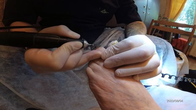 Выезд на дом. 83 года. часть 1