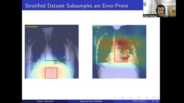 Reproducibility Challenge: Re-implementation of CheXNet using TensorFlow