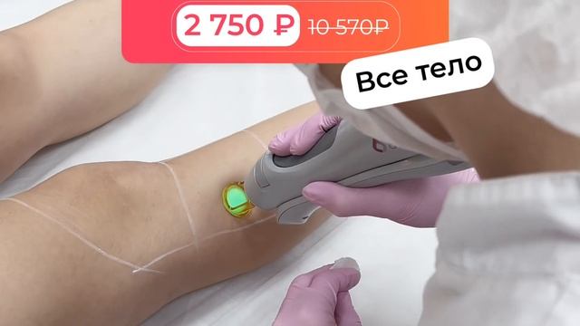 Лазерная эпиляция на александритовом лазере CANDELA в клинике UNI LASER