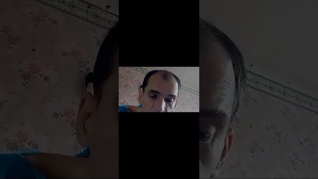 Mi Видео