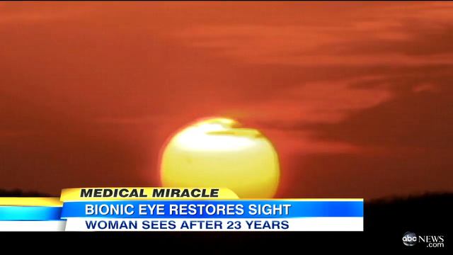 First Pair of 'Bionic Eyes' Glasses Helps People With Lost Vision