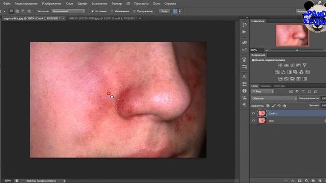 Урок 1. Photoshop. Як забрати прищі?