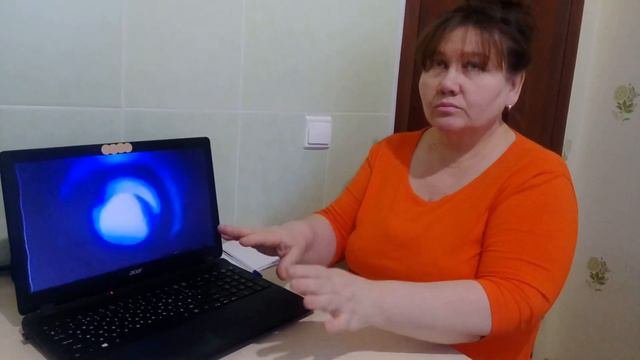 РЕАКЦИЯ НА ПЛАТИНА - ИНЕЙ