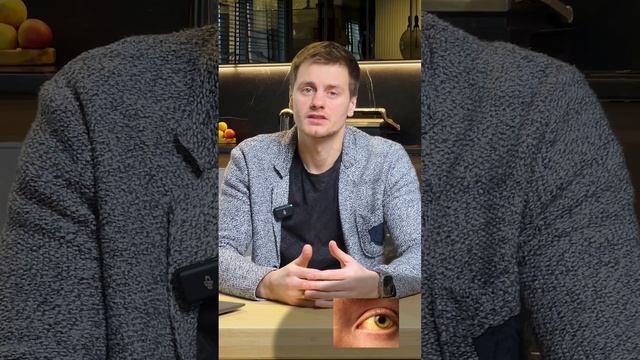 Темные круги под глазами? Это может говорить о...