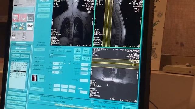 T Spine