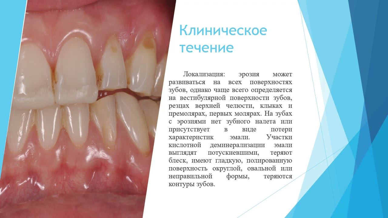 Лекция №3 для студентов 3 курса 5 семестра стоматологического факультета, французский