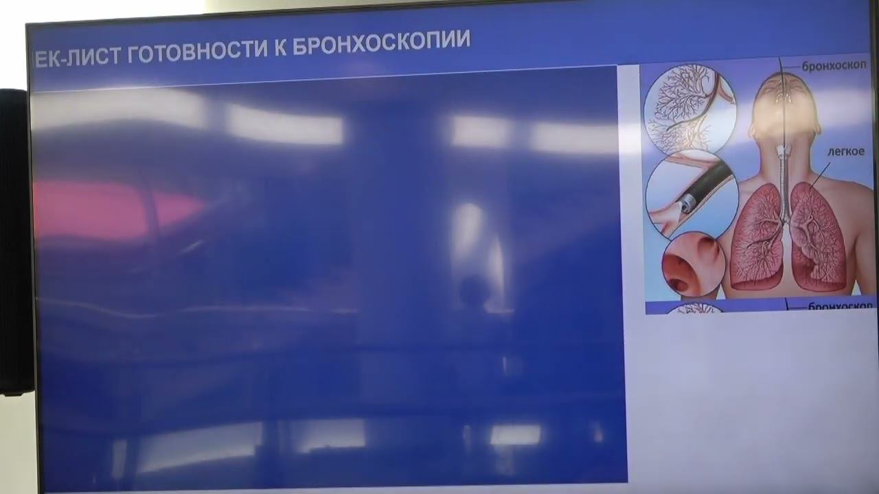 2024 06 22 Сестры10 Тытус АА Организационные аспекты бронхоскопии   что важно знать старшей медсестр