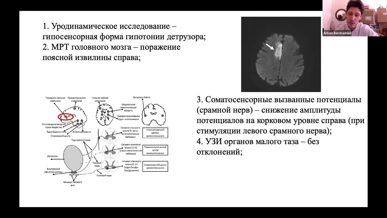 Апраксия мочеиспускания