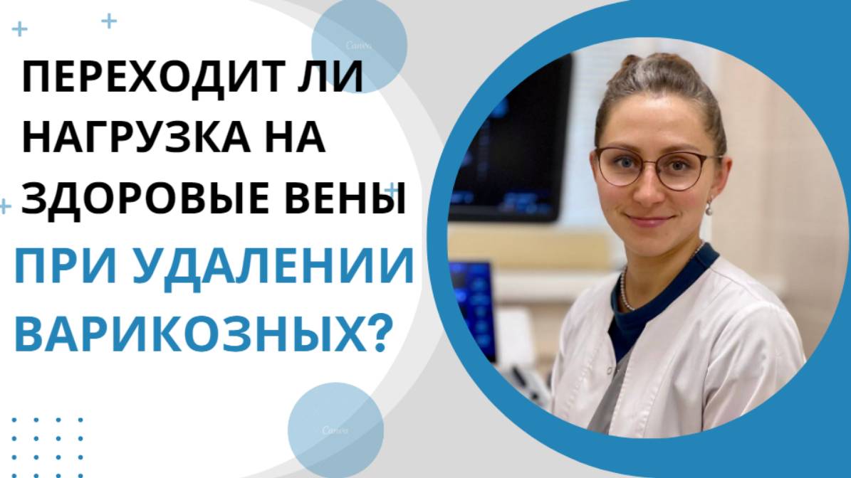 Переходит ли нагрузка на здоровые вены при удалении варикозных?