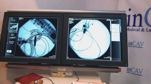 Cómo usar El Arco en C o Flurocopio Arcadis Orbic 3D