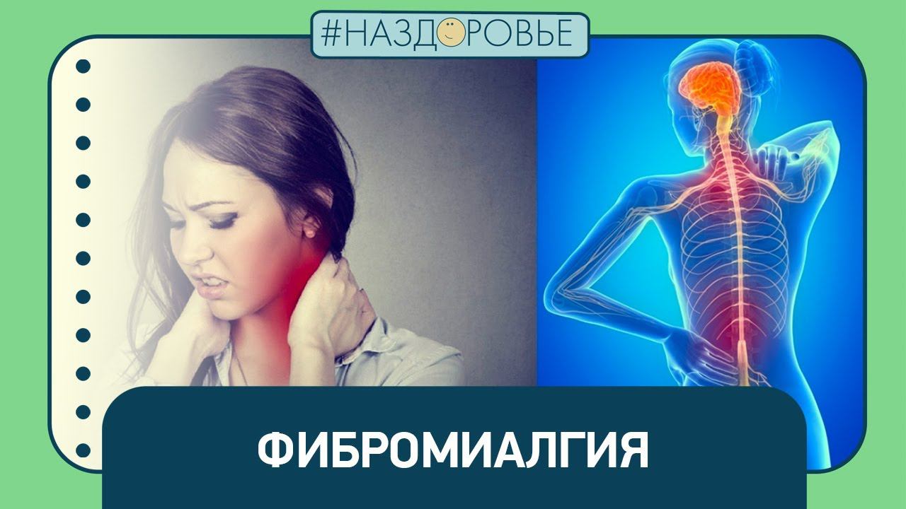 #НАЗДОРОВЬЕ: фибромиалгия