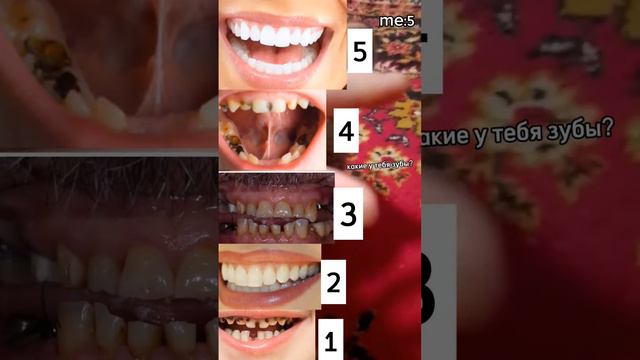 какие у тебя зубы?