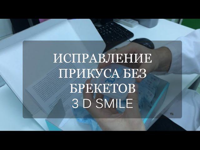 Выравнивание зубов без брекетов. Каппы 3D Smile.