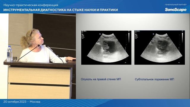 Алгоритм ультразвукового исследования при поступлении пациента с гематурией. Васильева М.А