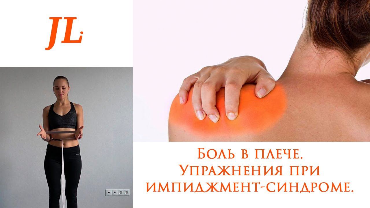 Упражнения при боли в плече. Импиджмент-синдром