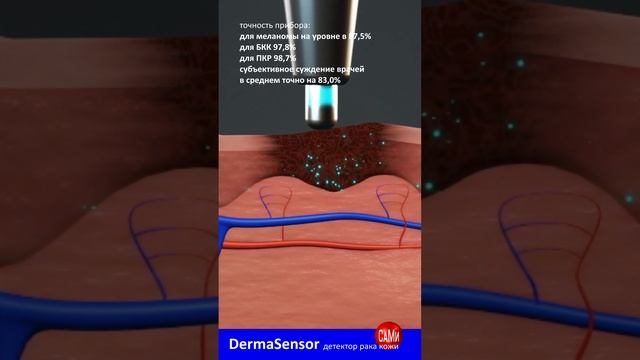 первый карманный ИИ-детектор DermaSensorанонс новости смартфон