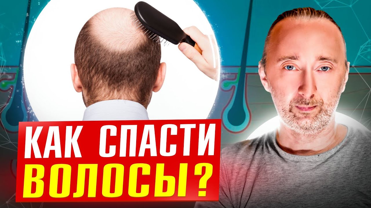 ВОЛОСЫ: все причины выпадения/ облысения! Как 100% отрастить густые волосы?