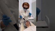 Карбоновый лазерный пилинг