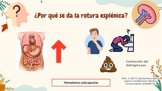MONONUCLEOSIS INFECCIOSA