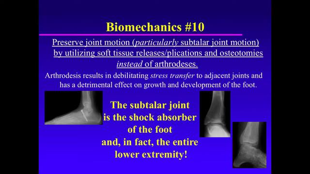 Biomechanics Of The Pediatric Foot. Principle 10. Preserve Joint Motion