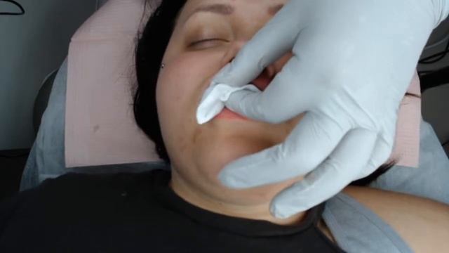 Russian Volume Doll Lips - LIVESTREAM