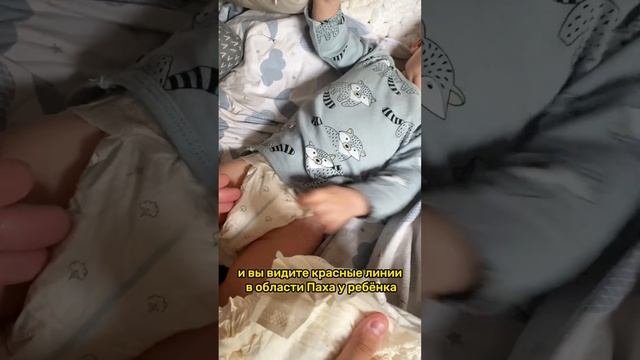 Для чего эта линия на подгузниках? #молдова #дети #подгузники