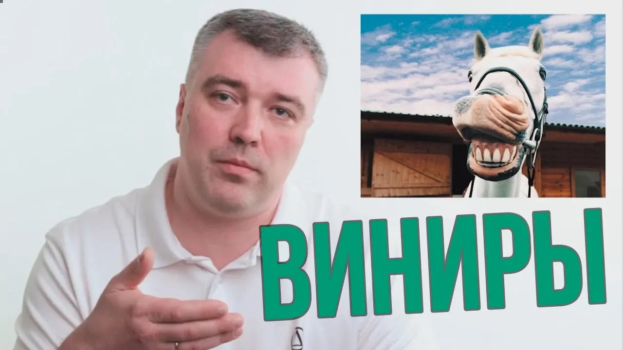 Виниры или люминиры? Какие подводные камни? Стоит ли устанавливать?