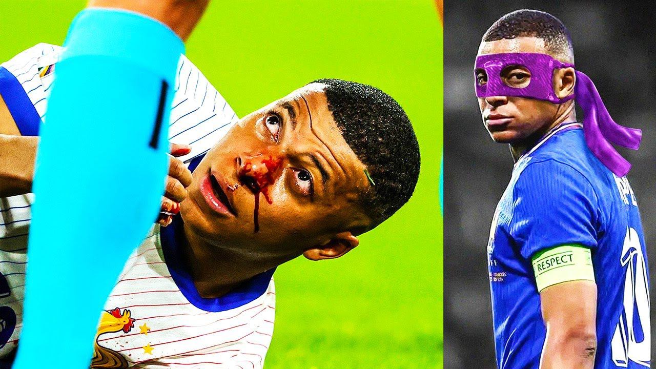 MBAPPE will MISS OUT ON THE REST OF THE EUROS!? The shocking truth about Kylian's injury!