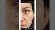 ✅ REMOVE EYE BAGS in a photo on YOUR PHONE