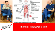 Инфаркт миокарда 2-го типа: ожидания и реальность