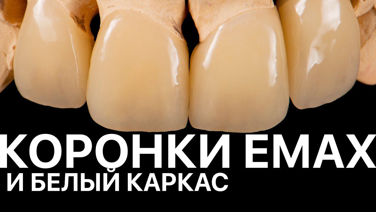 crown emax zirconia dental cad cam exocad ZrO2 коронки имакс