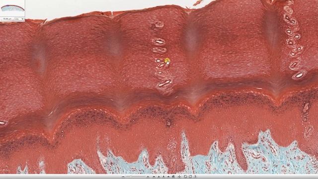 L'EPIDERME (partie 2) - HISTOLOGIE