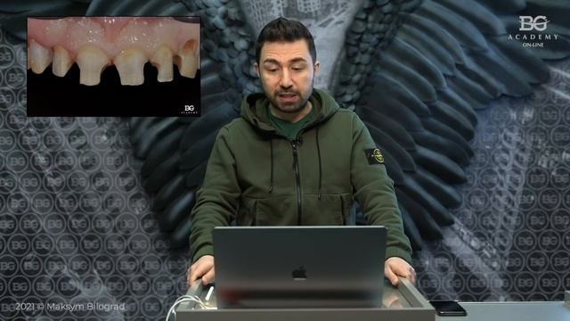 #Коронки и кариес | Дентал Кейсы от BG #18