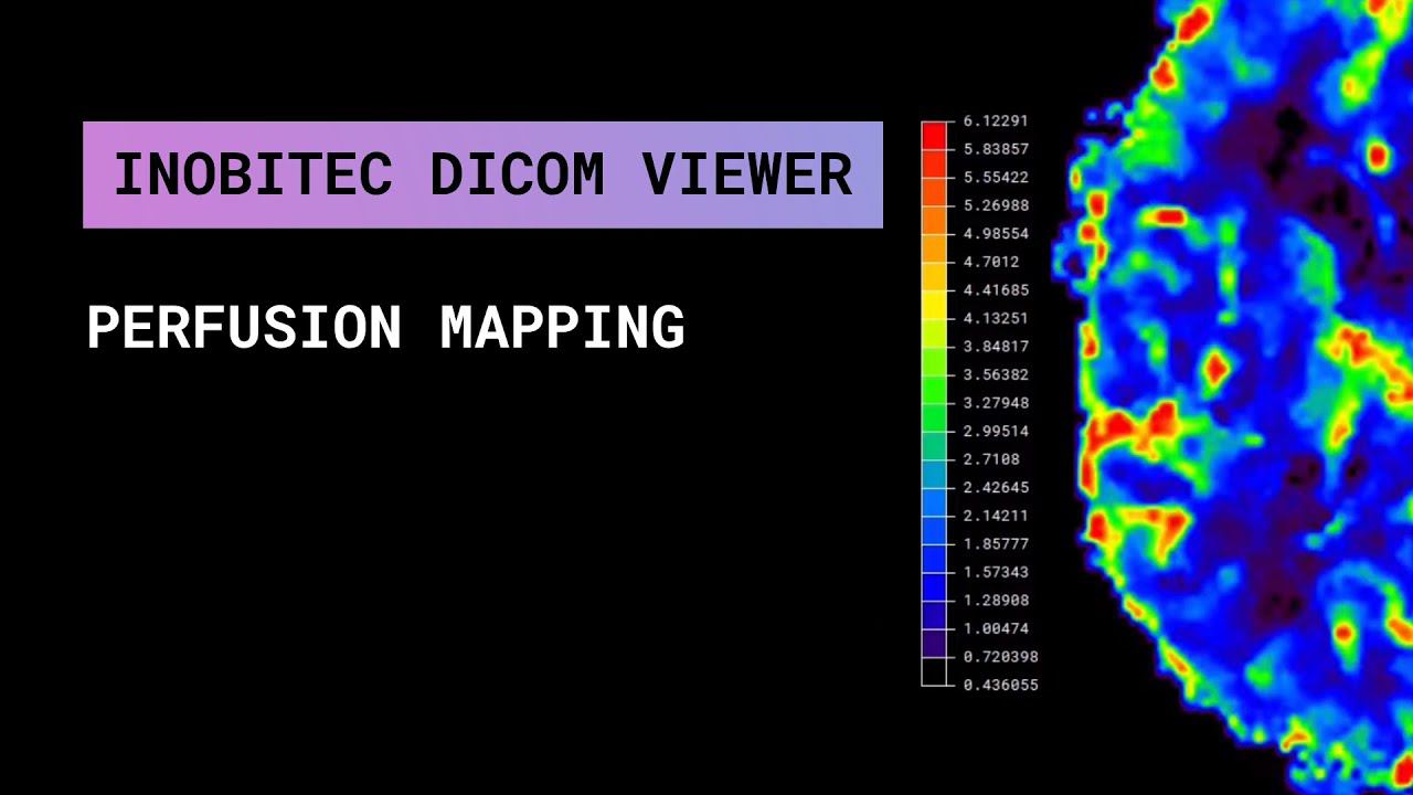 Одновременное отображение карт в режиме перфузии в программе Inobitec DICOM Viewer Pro