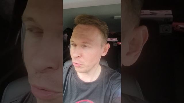 Пересадка волос спустя 8 месяцев.