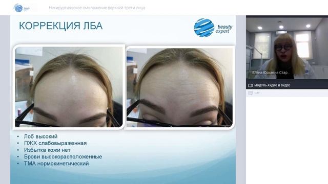 Вебинар «Нехирургическое омоложение верхней трети лица»