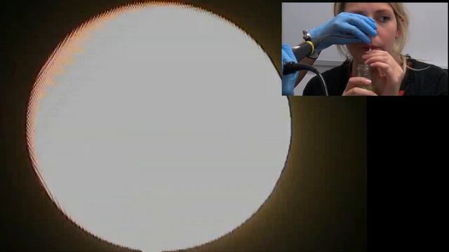 What happens when you have a fibre-optic endoscopic evaluation ofswallowing