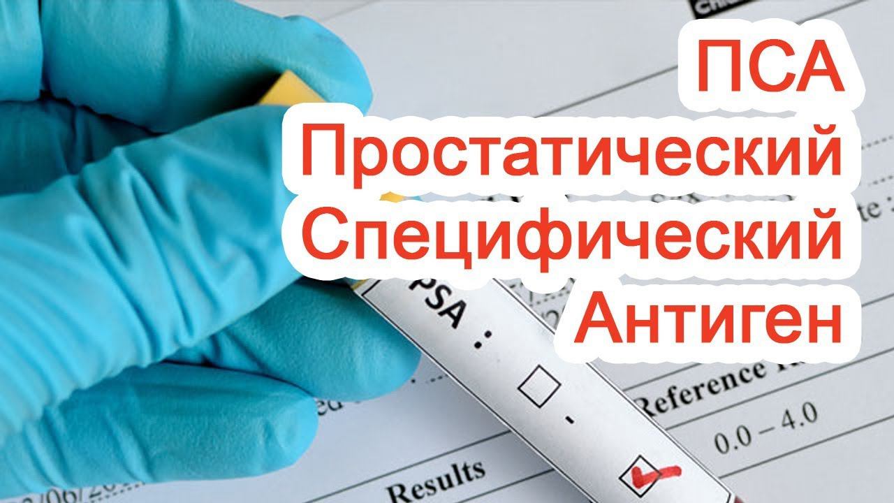 Простатический Специфический Антиген – ПСА / Доктор Черепанов