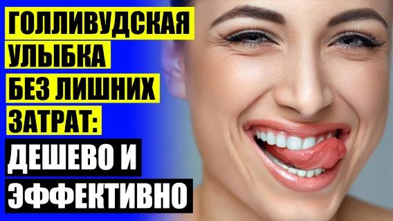 😀 ВИНИРЫ НА ЗУБЫ ЧТО ЭТО ТАКОЕ