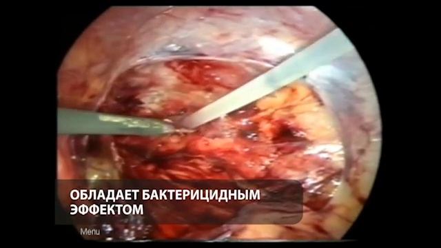 Гемостатик "гель сургитамп"