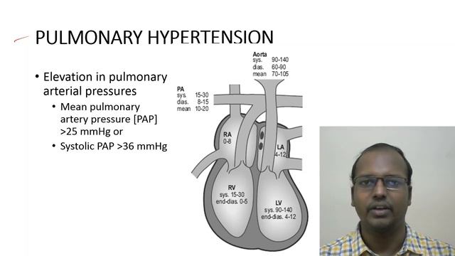 Atrial Fibrillation  &  Pulmonary Hypertension