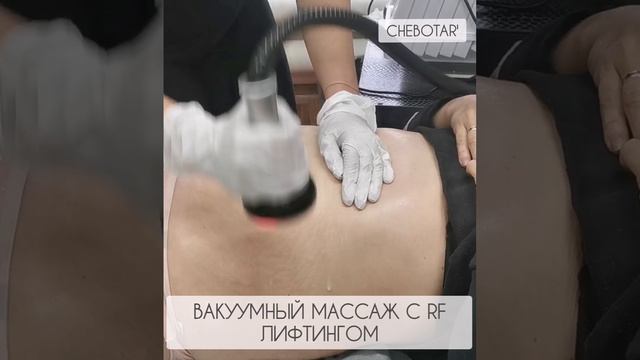 1 день - вакуумный массаж с RF лифтингом