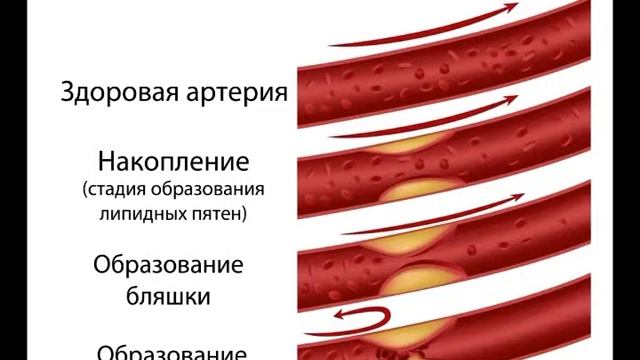 О кислородных капсулах