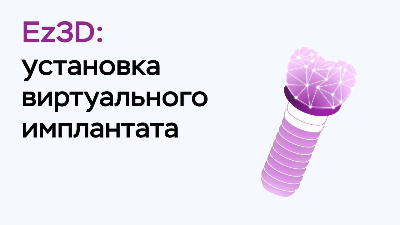 Возможности программы Ez3D: установка виртуального имплантата