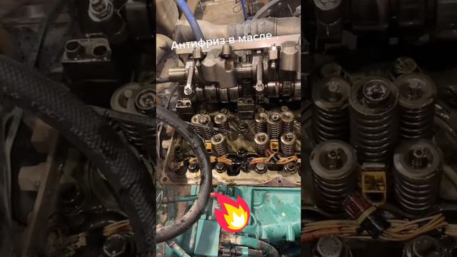 VNL