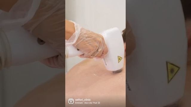 Мужчины тоже делают это! Лазерная эпиляция нежелательных волос на любых участках тела!